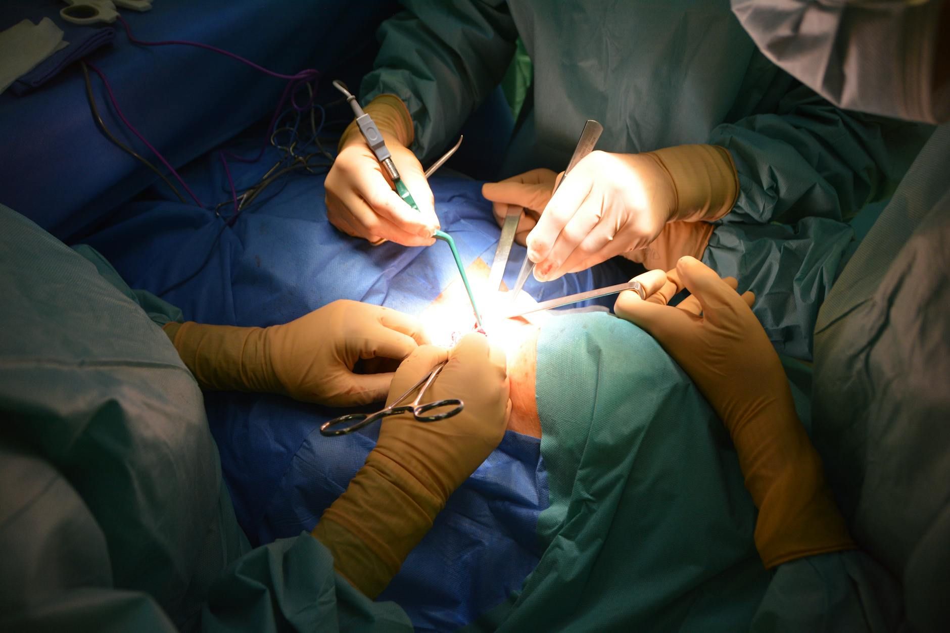 Say Goodbye to Scars: The Revolutionary Hysterectomy Method You Need to Know